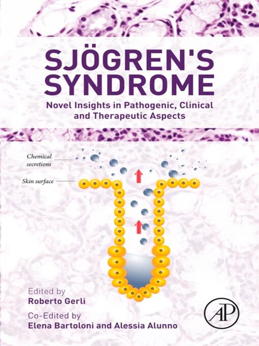 Cover image for Sjogren's Syndrome